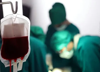 transfusão, transfusões de sangue;